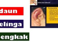 daun-telinga-berkerak-sehat-21723846417.jpg