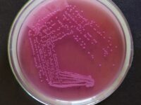 macconkey-agar-klebsiella-sehat-21723745501.jpg
