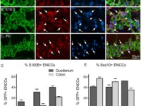 s100b-expression-enteric-sehat-21723663300.jpg