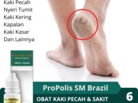 telapak-kaki-kering-bersisik-sehat-21723812914.jpg